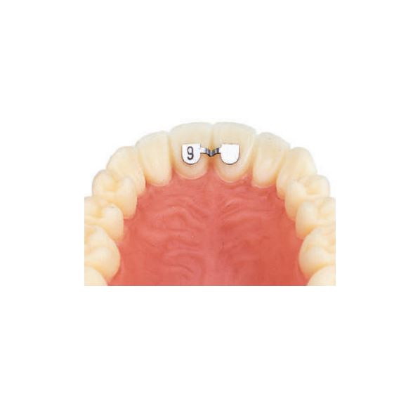 Retainer horní 1-1 10 ks