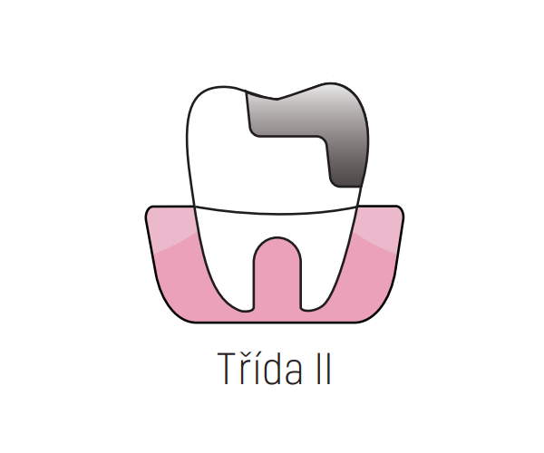 Třída II