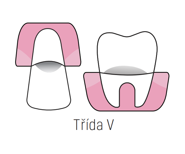 Třída IV