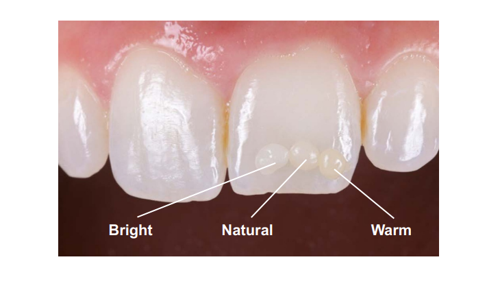 Výběr odstínu intuitivně a přímo - Filtek Easy Match Universal Restorative