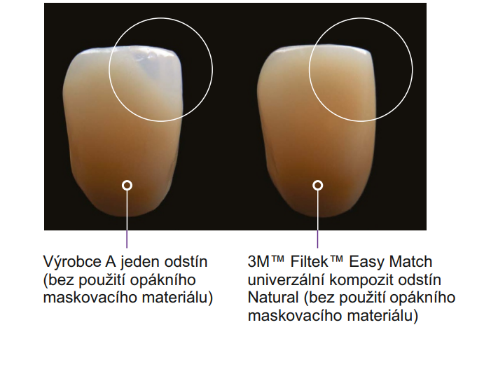 Síla přirozeně adaptivní opacity - Filtek Easy Match Universal Restorative